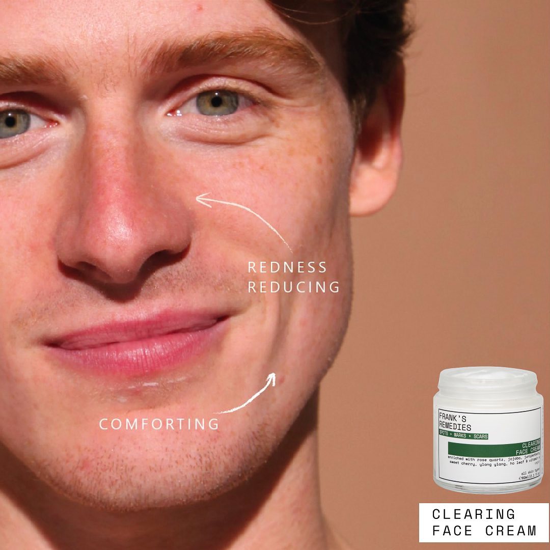 Clearing Face Cream for fet og uren hud